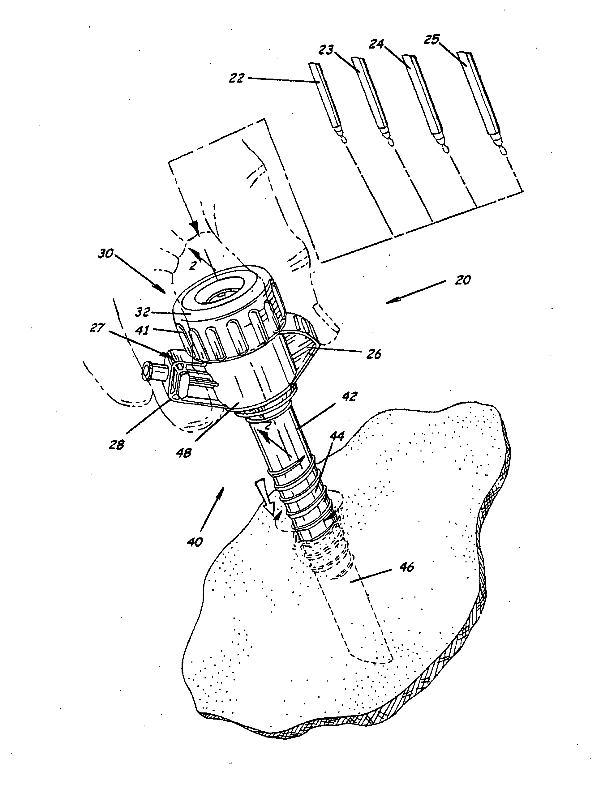 Trocar and cannula assembly having conical valve and related methods