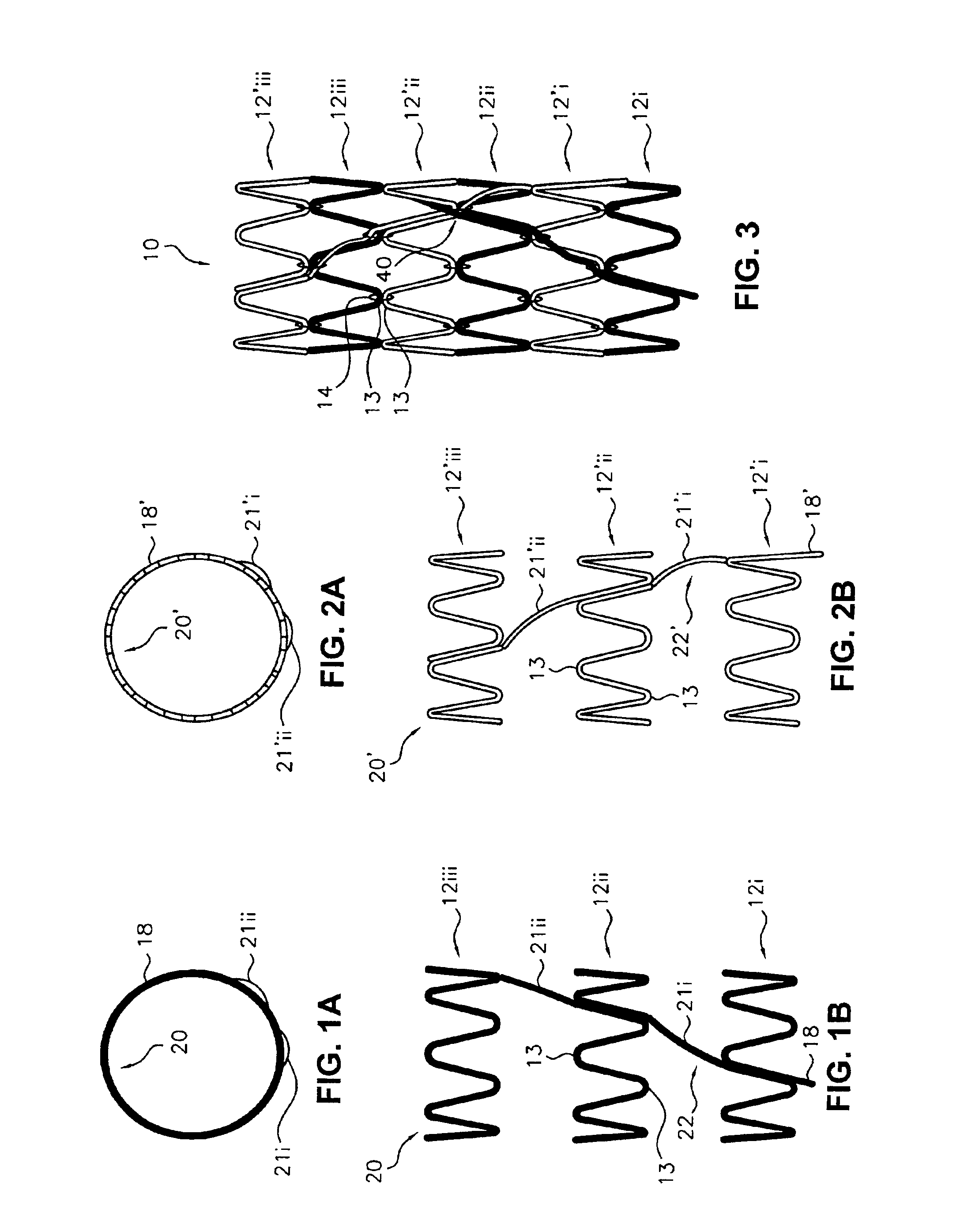 Flexible endoluminal stent and process of repairing a body lumen