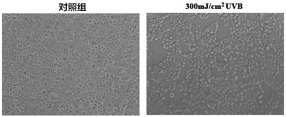 Protection effect of cyanidin-3-glucoside for UVB (ultraviolet B)-induced HaCaT cell injury