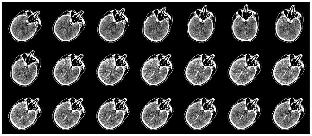 Motion amplitude automatic estimation method for CT and MR brain perfusion data