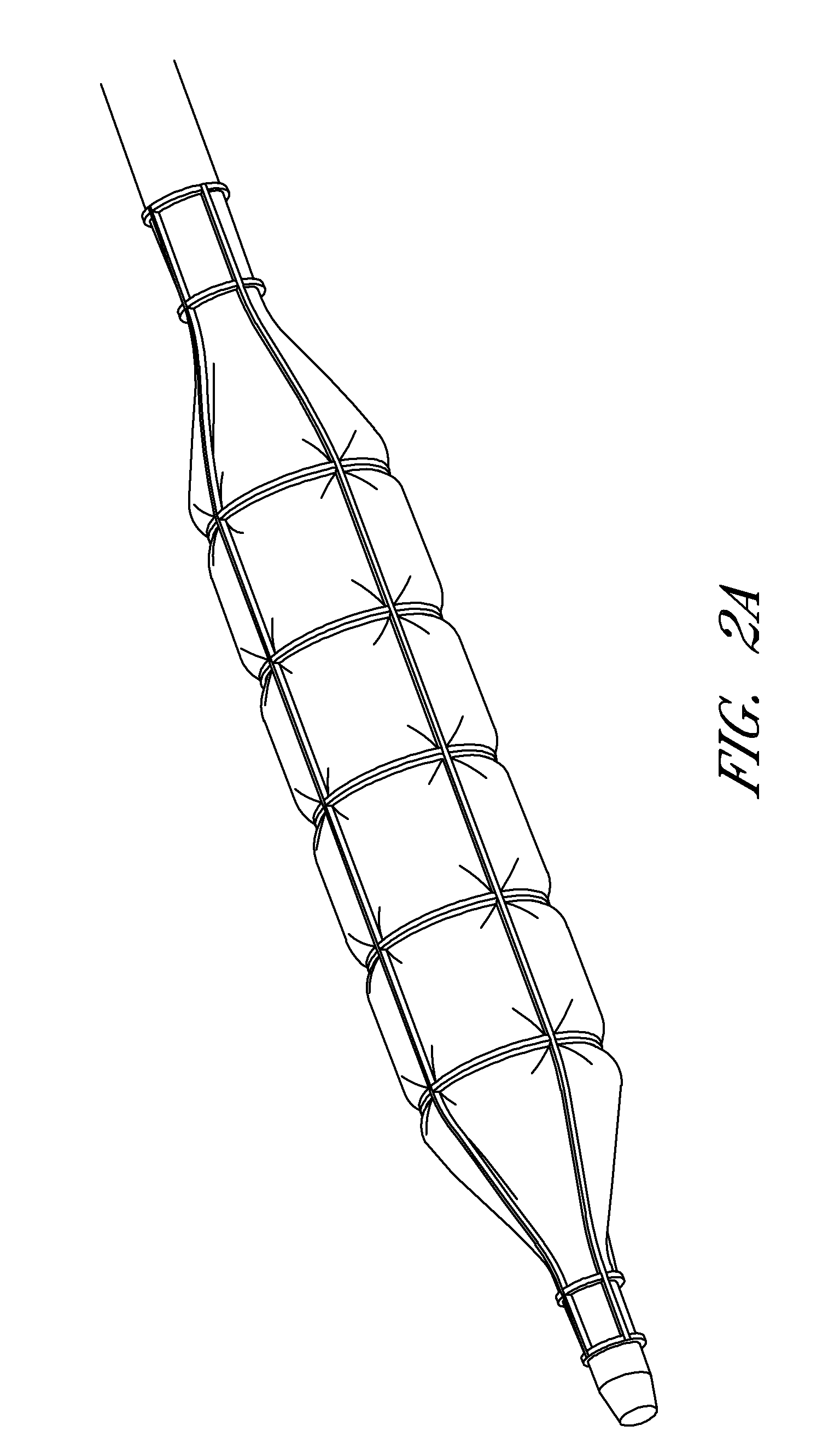 Device for compartmental dilatation of blood vessels