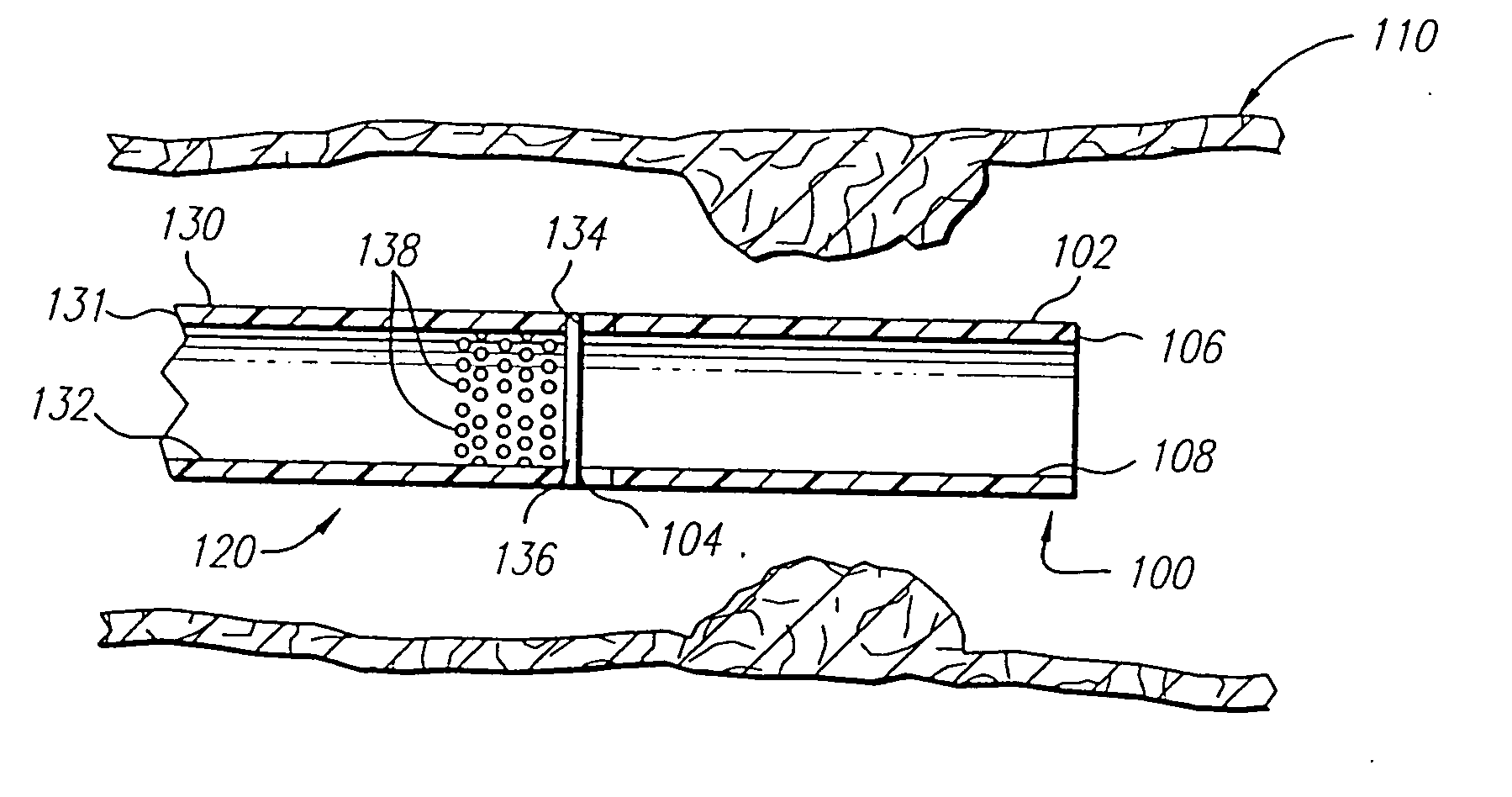 Stent delivery catheter and method of use