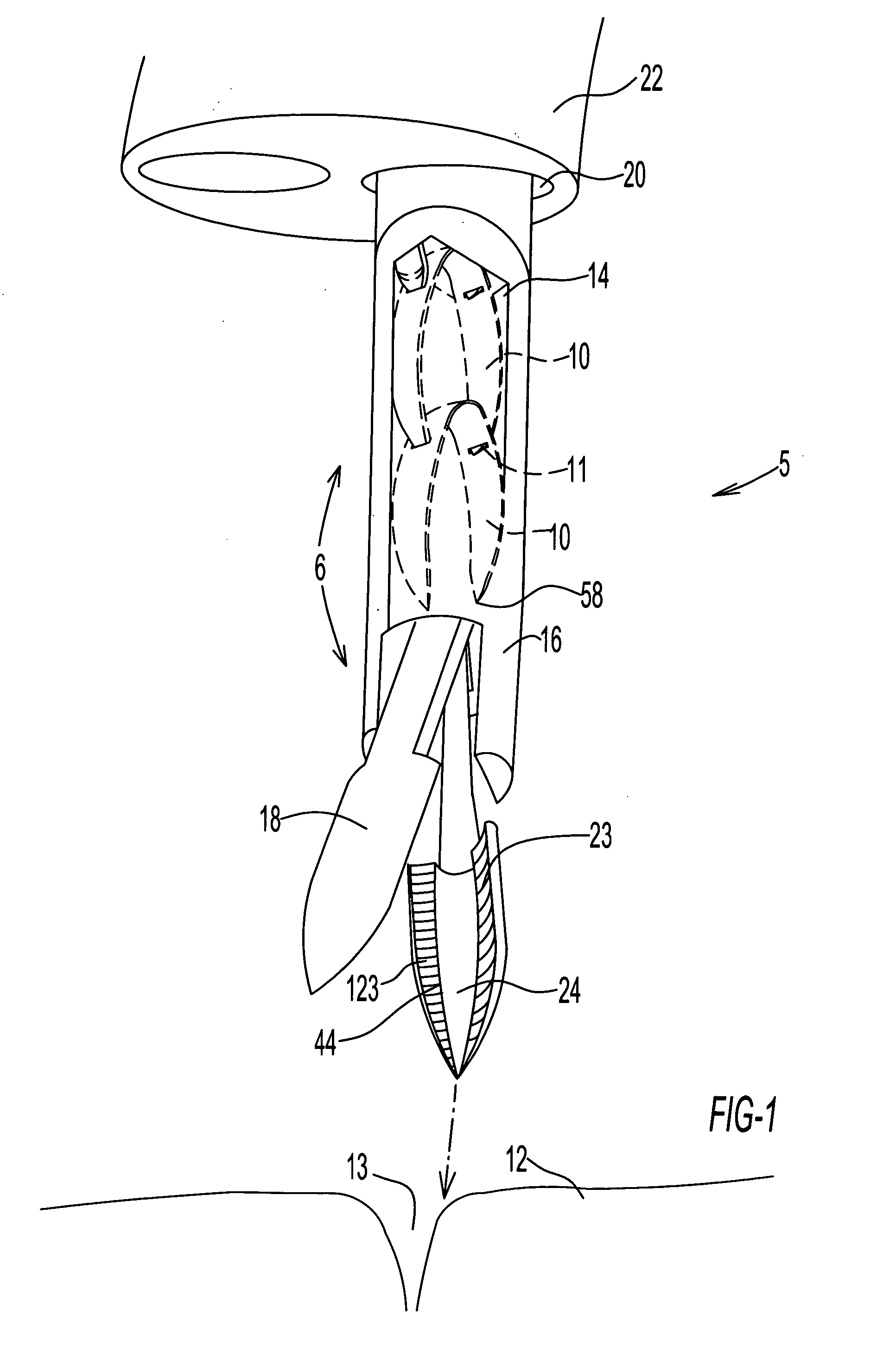 Endoscopic fastening system with multiple fasteners