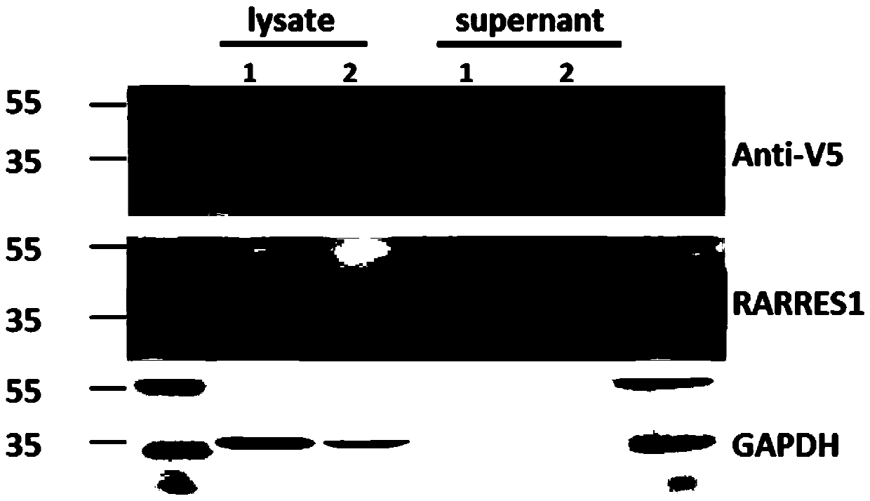 Application of retinoic acid receptor reactive protein 1 as biomarker in chronic kidney disease