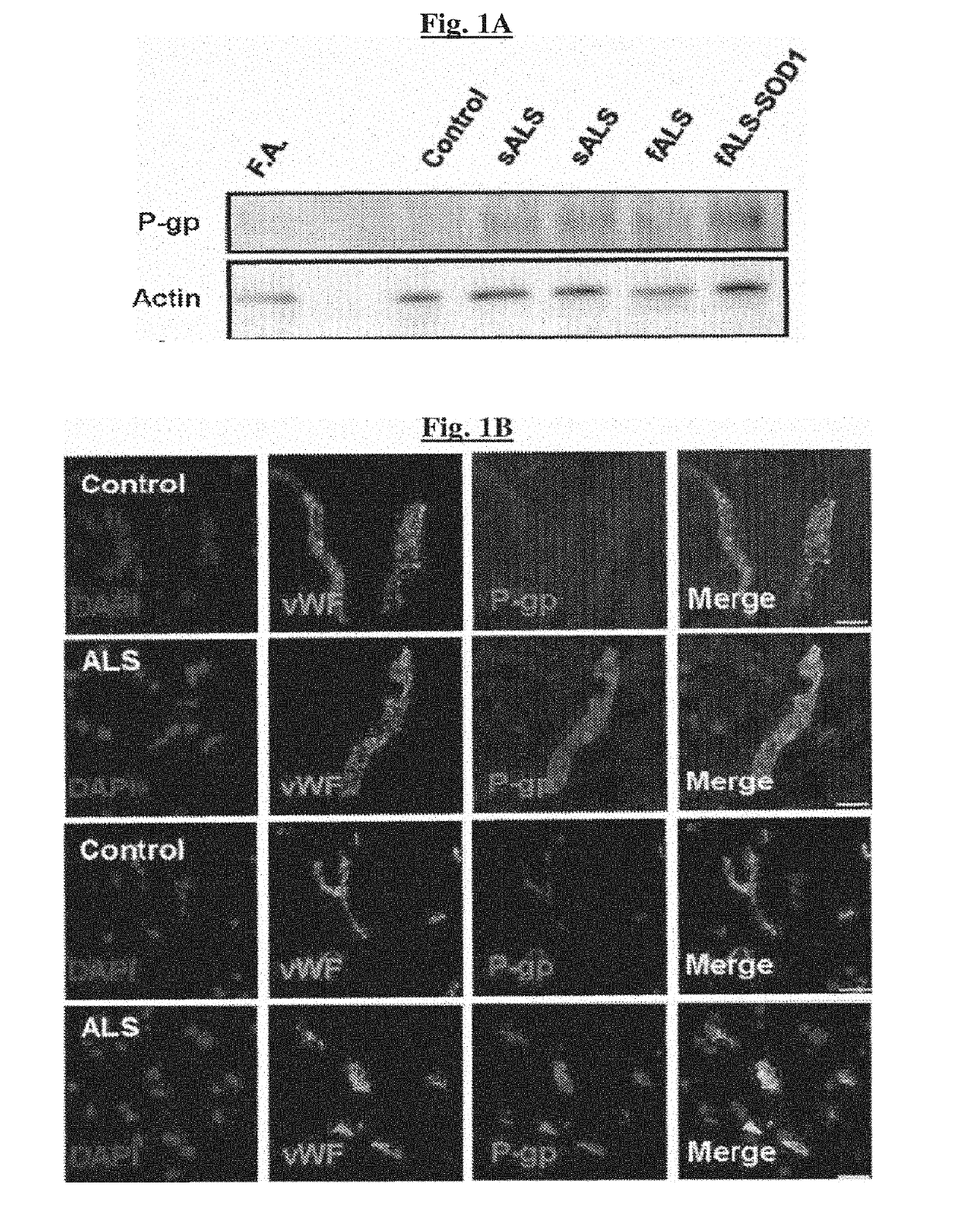 Novel methods of treating a neurodegenerative disease in a mammal in need thereof