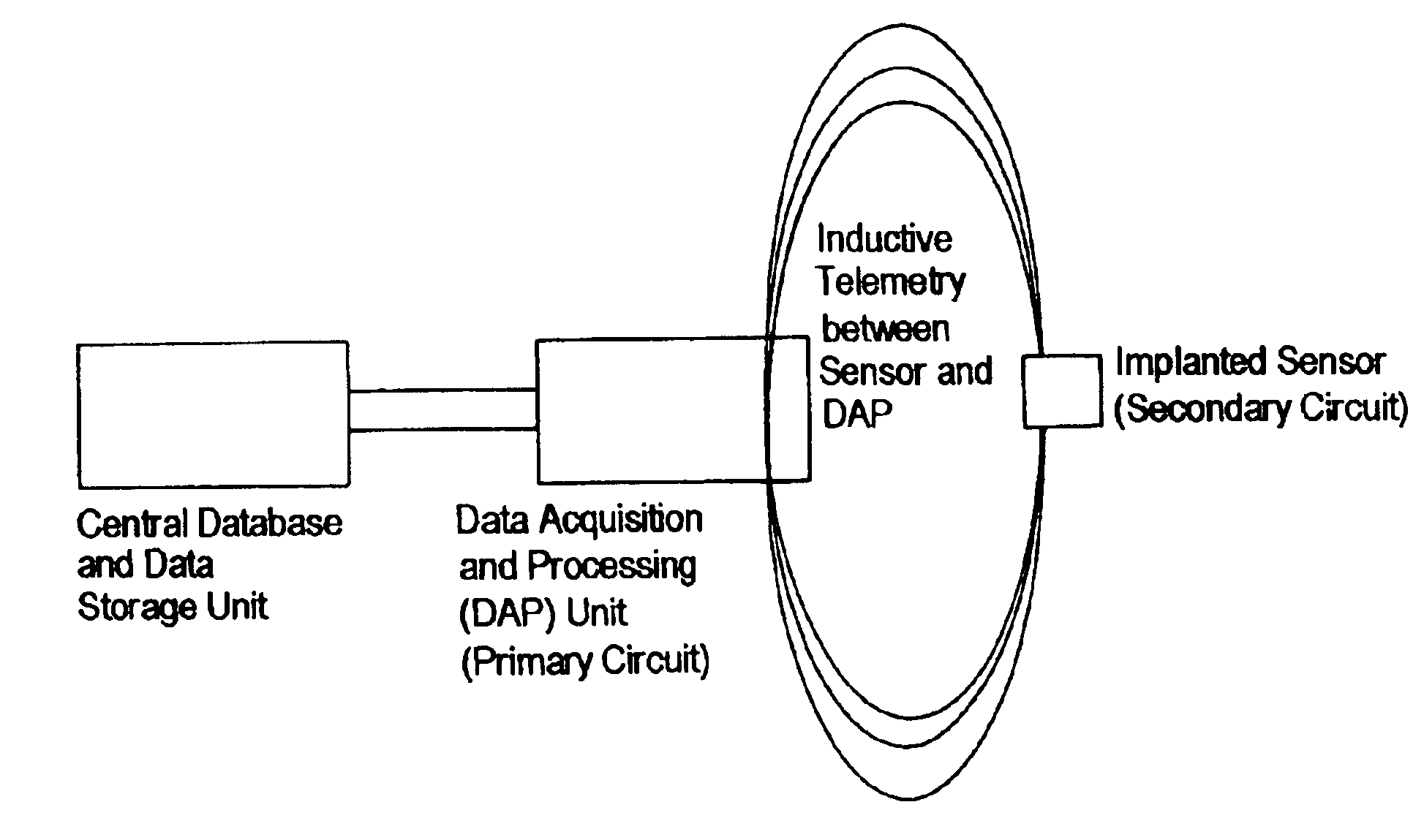 Implantable microscale pressure sensor system for pressure monitoring and management