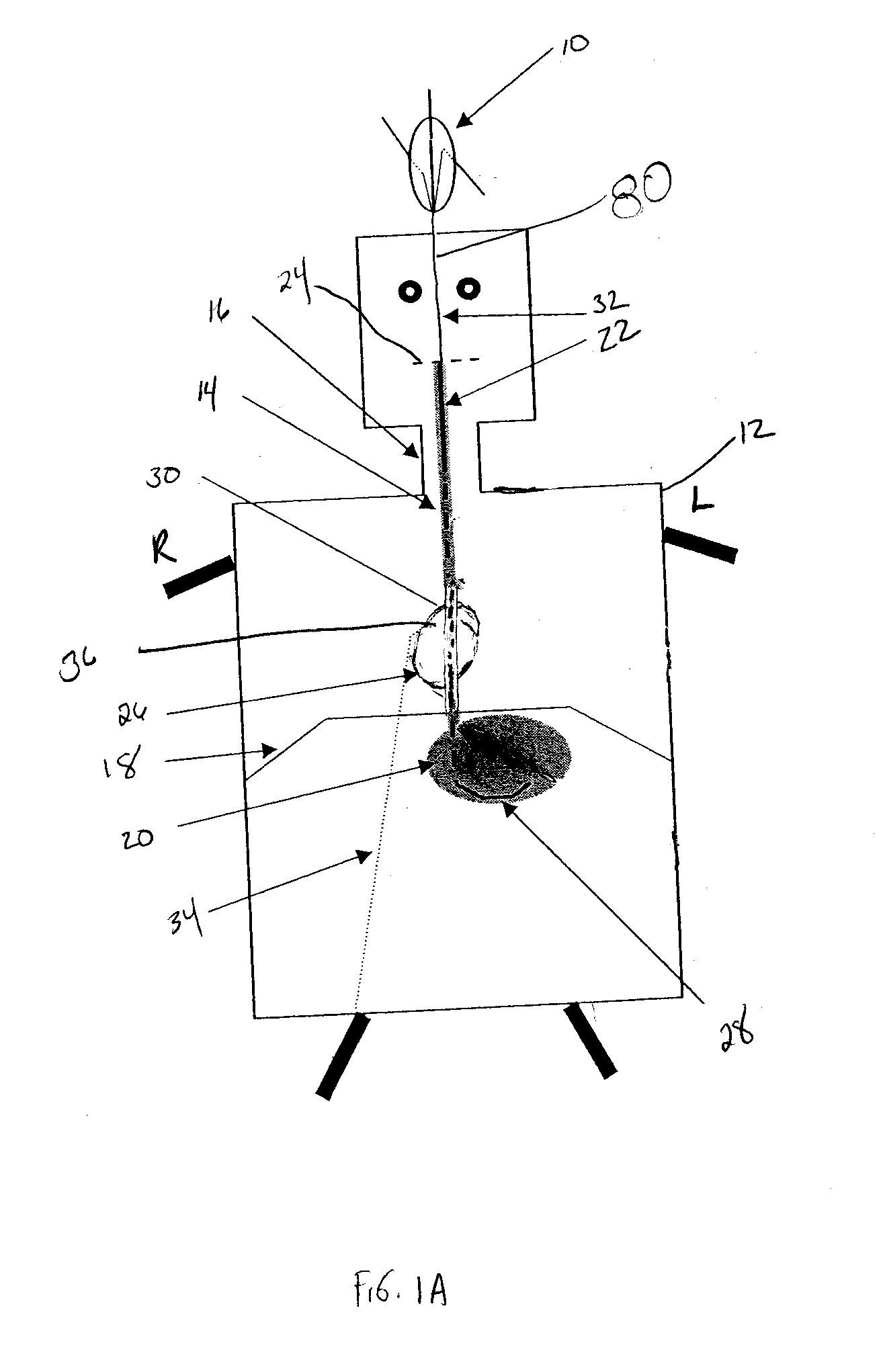 System and method for influencing an anatomical structure