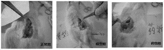 Traditional Chinese medicine composition used for treating prostatitis or benign prostatic hyperplasia