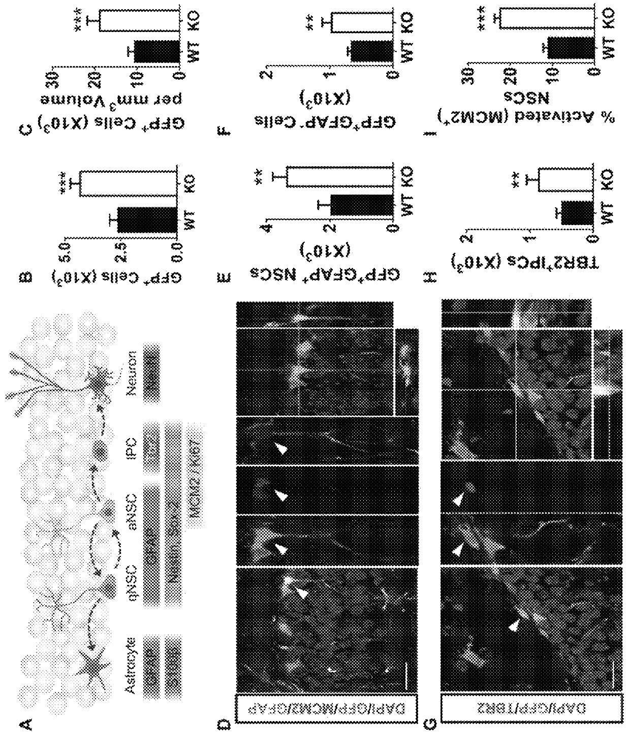 Methods for treating cognitive deficits associated with fragile X syndrome