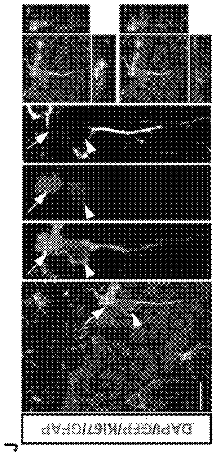 Methods for treating cognitive deficits associated with fragile X syndrome