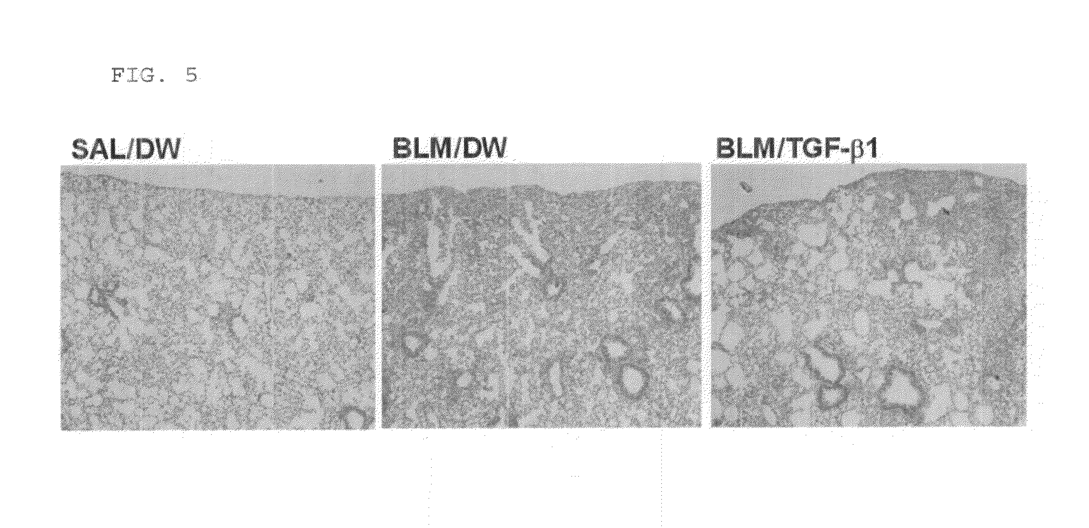 Preventive or therapeutic agent for fibrosis