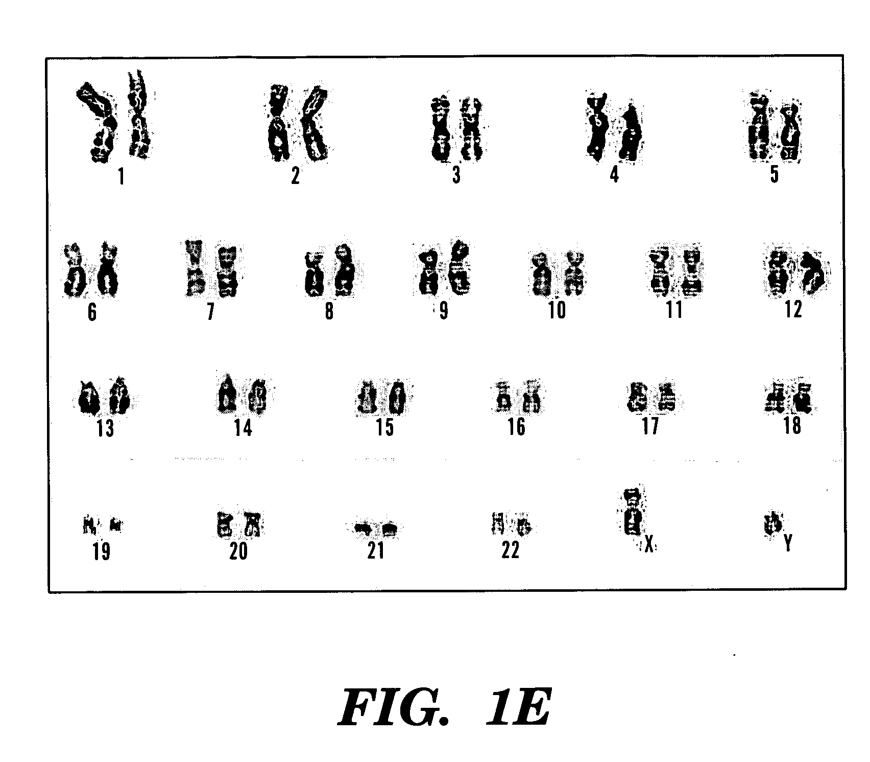 Methods of isolation, expansion and differentiation of fetal stem cells from chorionic villus, amniotic fluid, and placenta and therapeutic uses thereof