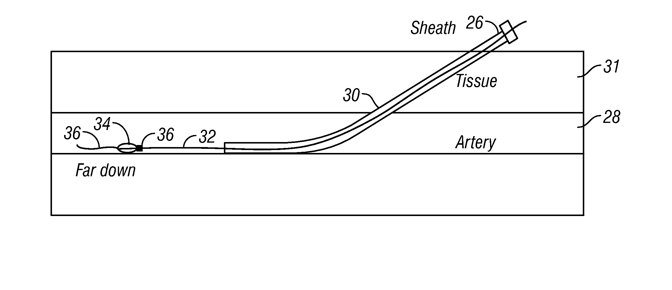 Systems and methods for sealing a vascular opening