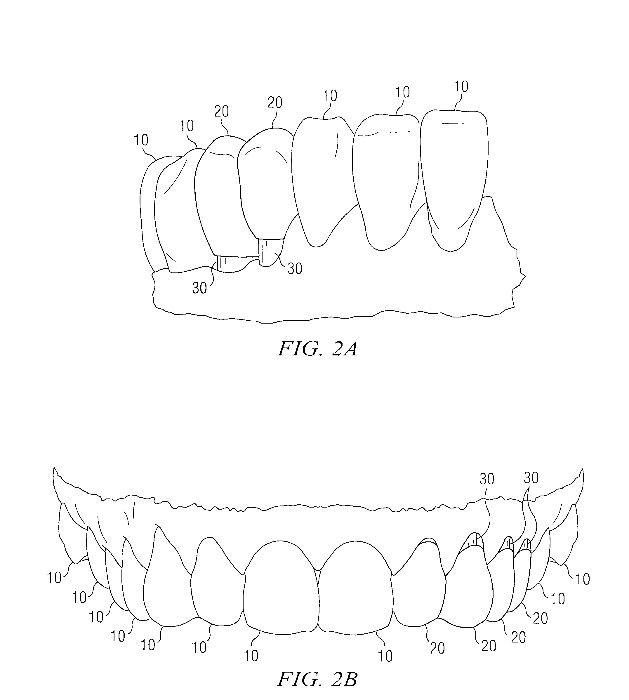 Dental Implant Device and Screw