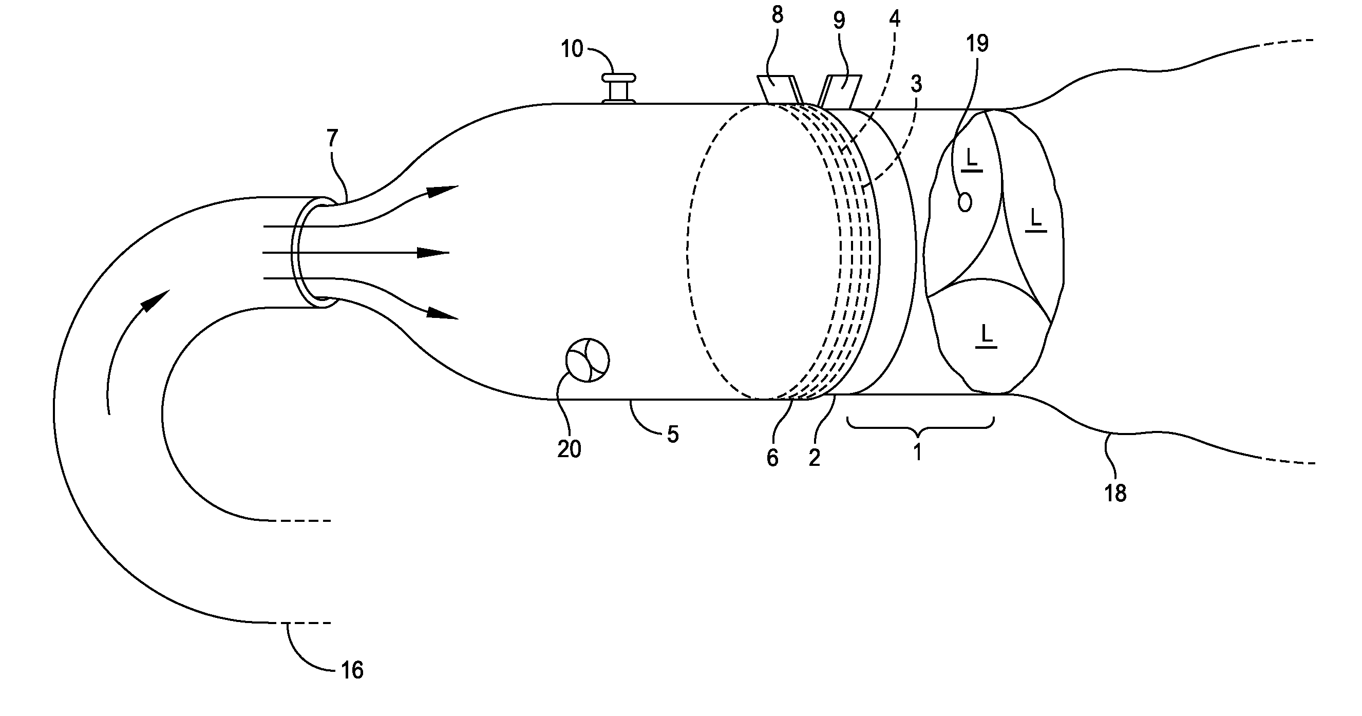 Apparatus and method for simulation of diastole and visualizing the diastolic state of an aortic valve and root during cardiac surgery