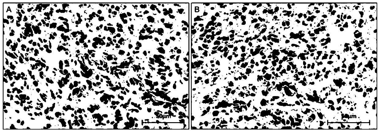 Polypeptide specially bound with mycobacterium tuberculosis, and coding gene and application of polypeptide