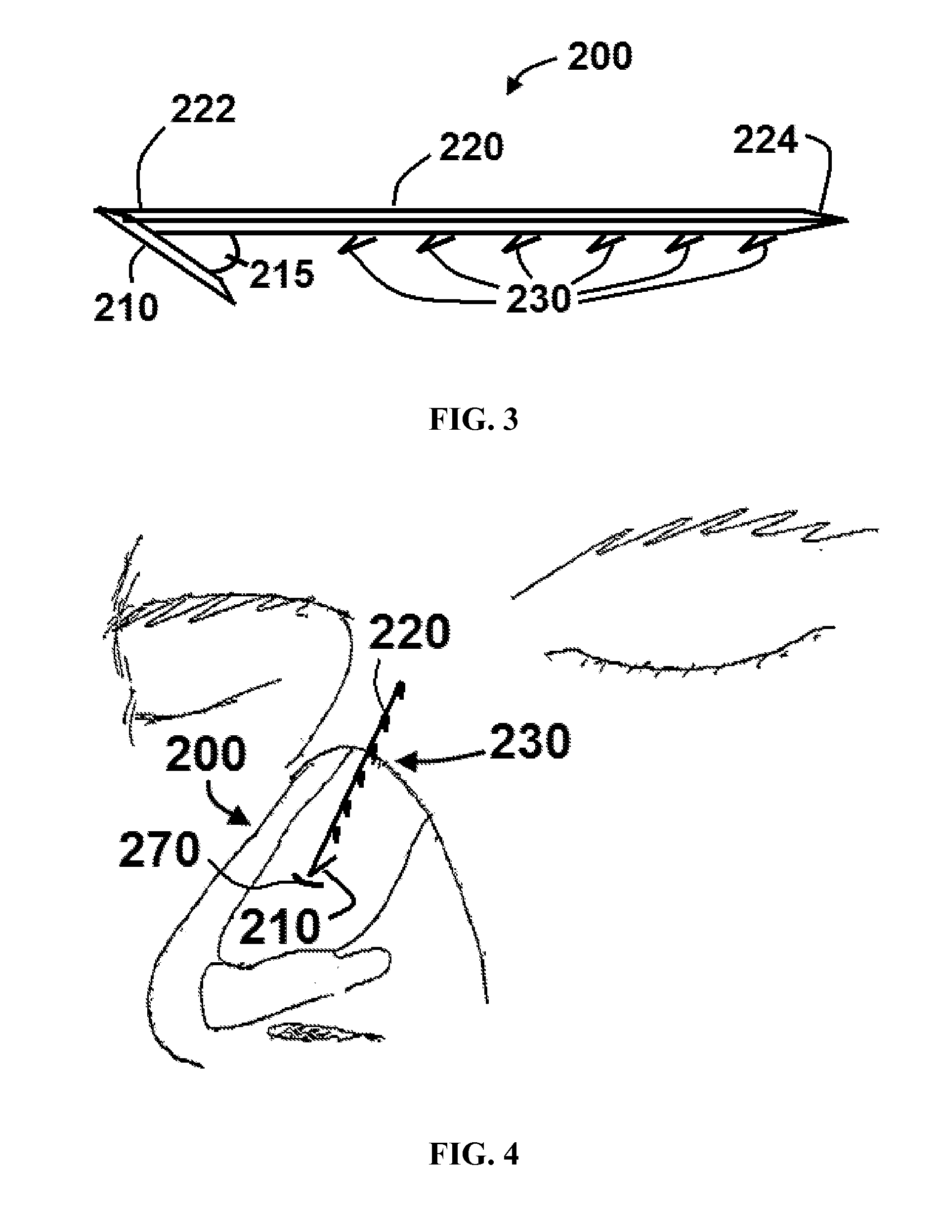 Apparatus and methods for correcting nasal valve collapse