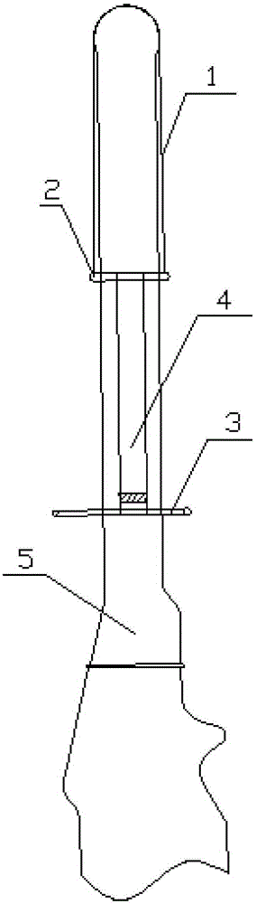 An intracavity ultrasonic probe isolation sleeve