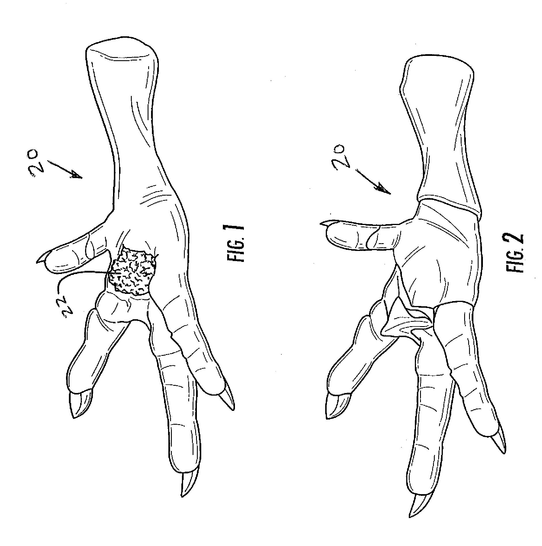 Device for Removing Material from Feet of Poultry