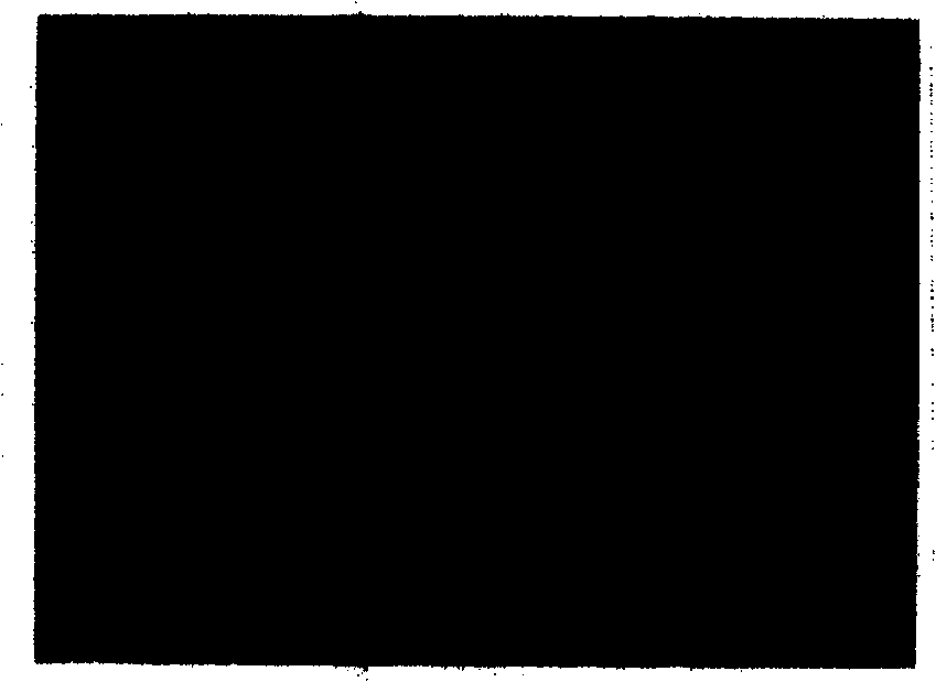 Process for preparing composite coat of hydroxy apatite and aluminum oxide