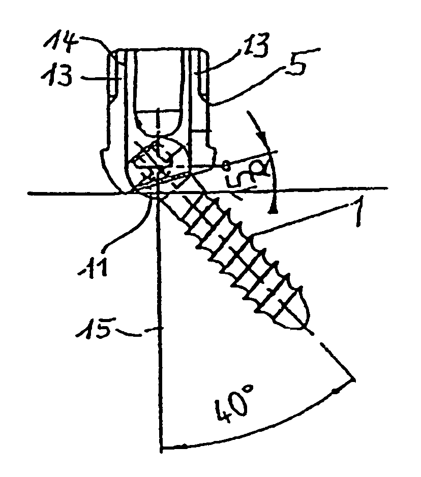 Bone screw