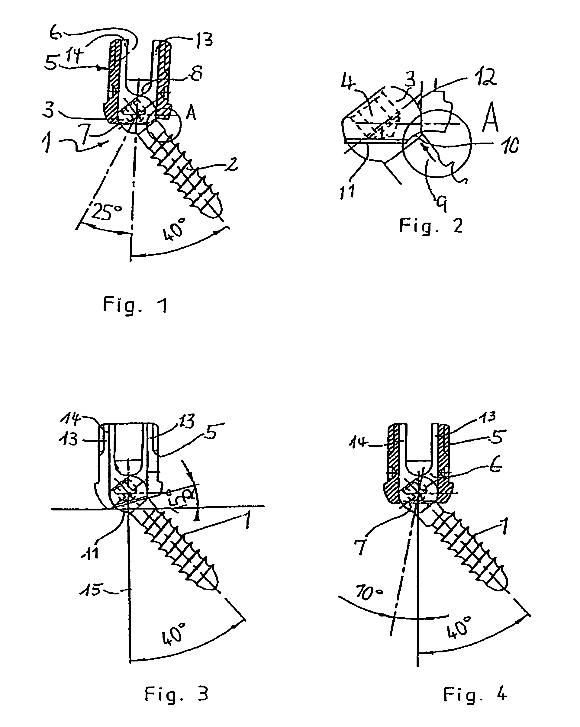 Bone screw