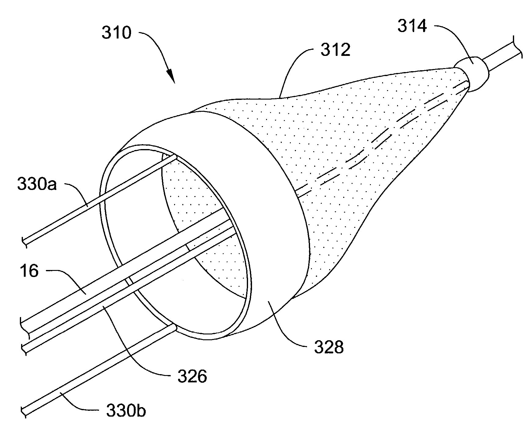 Multi-wire embolic protection filtering device