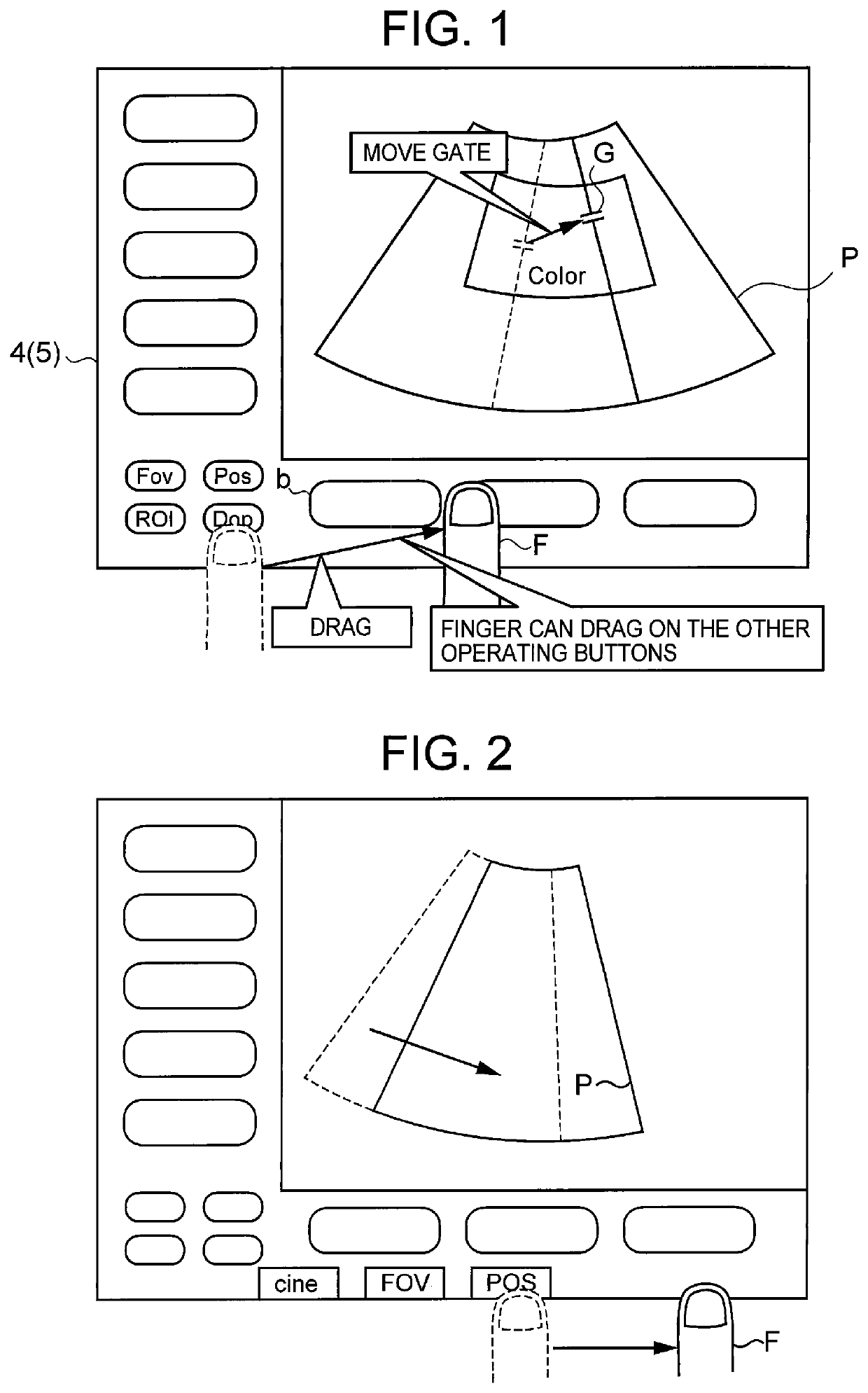 Ultrasonograph