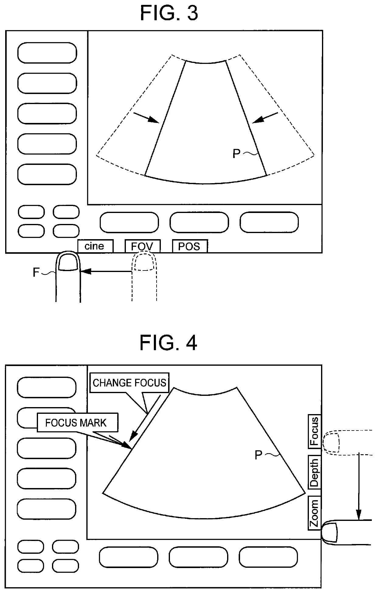 Ultrasonograph