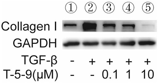 Application of phthalazine derivative to treatment of hepatic fibrosis diseases