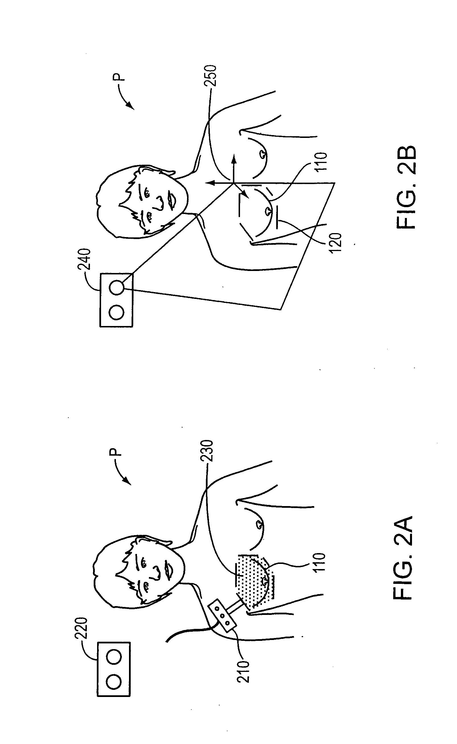 System and method for patient setup for radiotherapy treatment