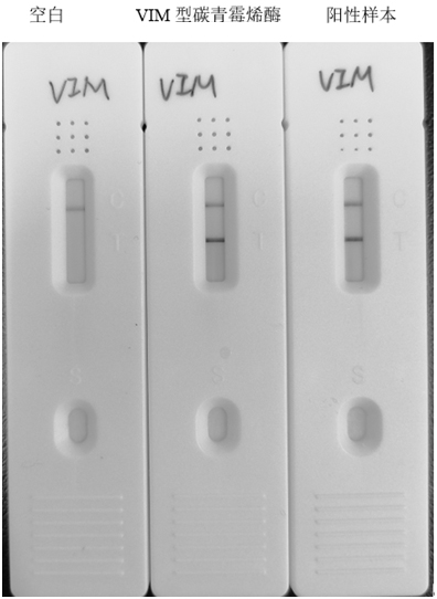 Anti-VIM carbapenemase hybridoma cell strain, monoclonal antibody and application