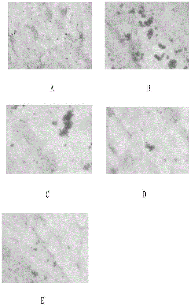 Application of Herba Ecliptae extract to preparation of anti-osteoporosis multi-target medicines or healthcare products