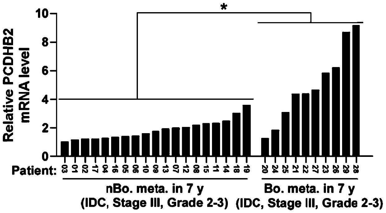 Novel target PCDHB2 for breast cancer osseous metastasis diagnosis and treatment