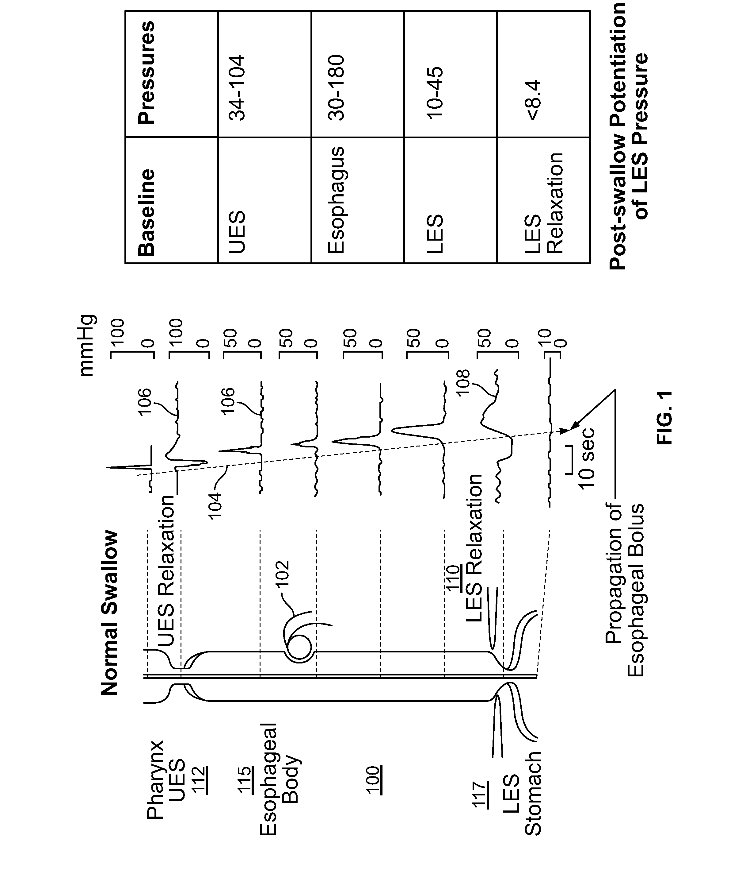 Device and Implantation System for Electrical Stimulation of Biological Systems