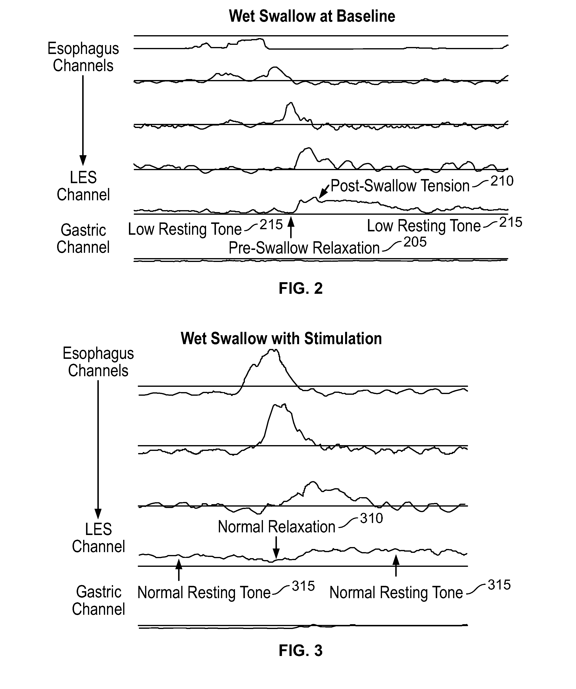 Device and Implantation System for Electrical Stimulation of Biological Systems