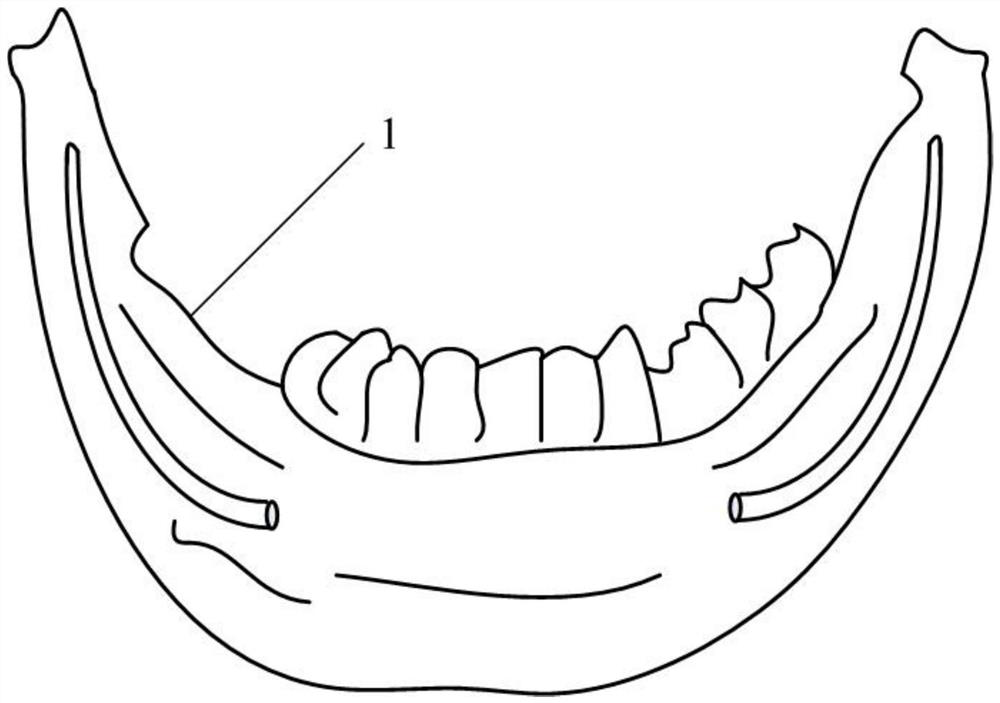 Dental implant reconfigurable guide plate and manufacturing method thereof