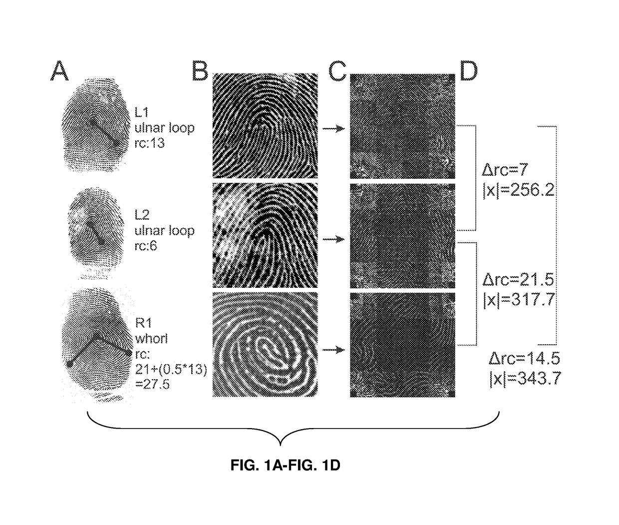 detection-systems-using-fingerprint-images-for-type-1-diabetes-mellitus