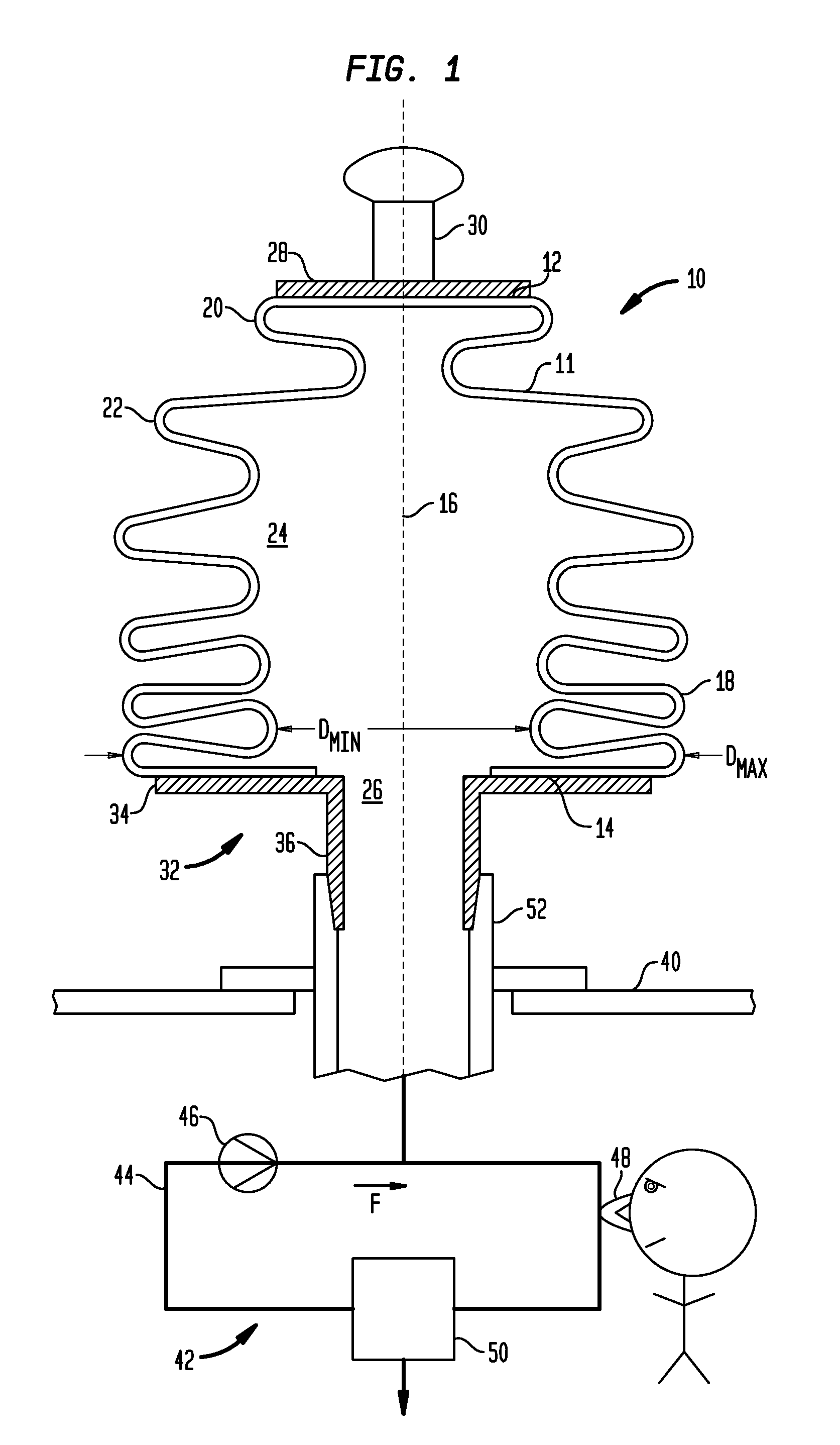 Ventilating element, system, and methods