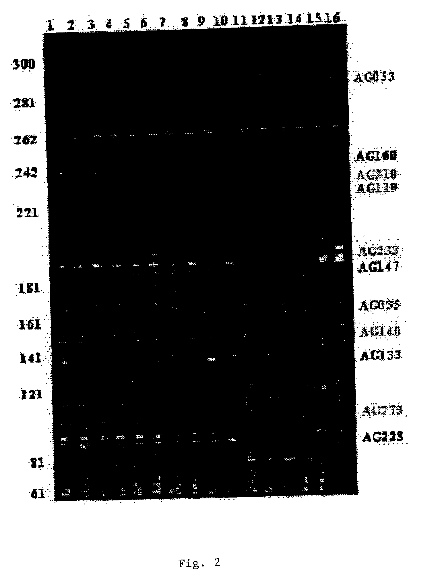 Method for cloning animals with targetted genetic alterations by transfer of long-term cultured male or female somatic cell nuclei, comprising artificially-induced genetic alterations, to enucleated recipient cells