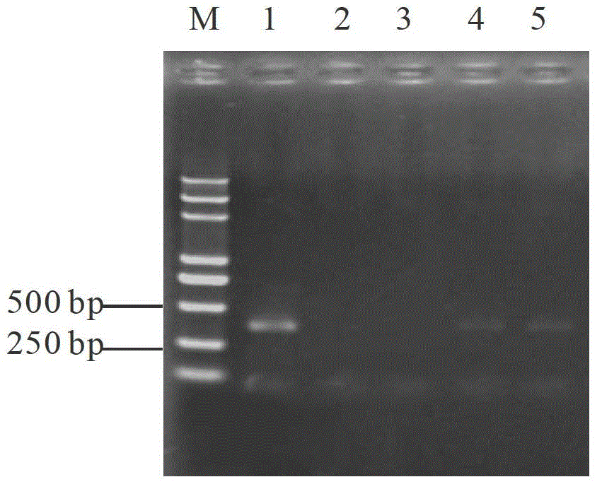 Primers used for rapid detection of Neofusicoccum parvum and application thereof