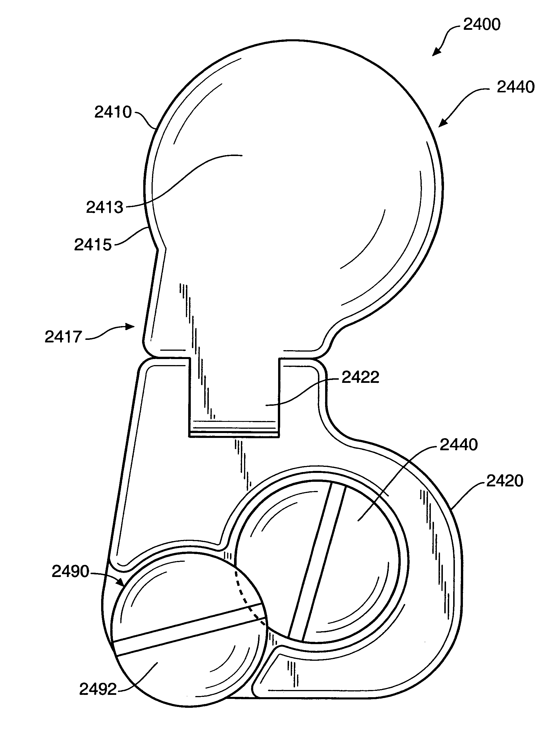 Inter-cervical facet implant and method for preserving the tissues surrounding the facet joint