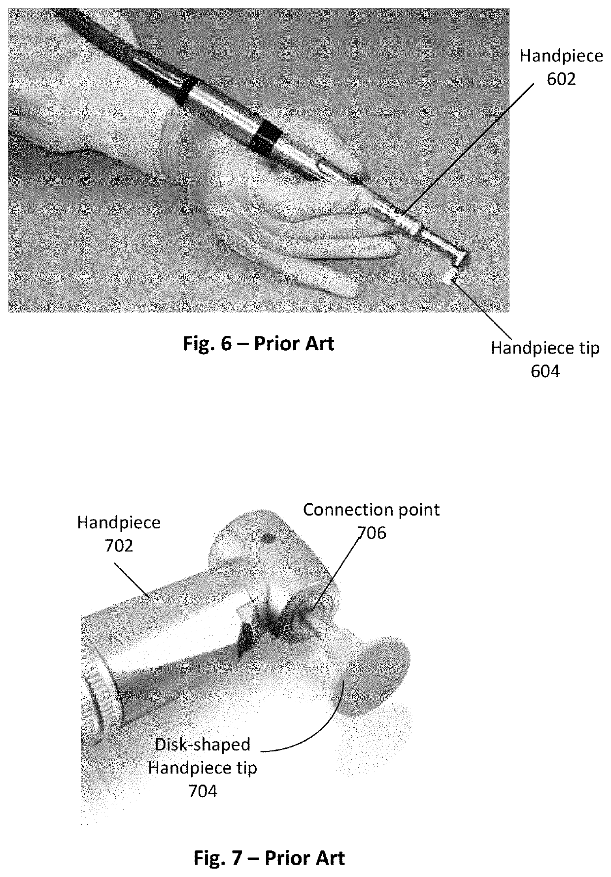 Interproximal polishing bur