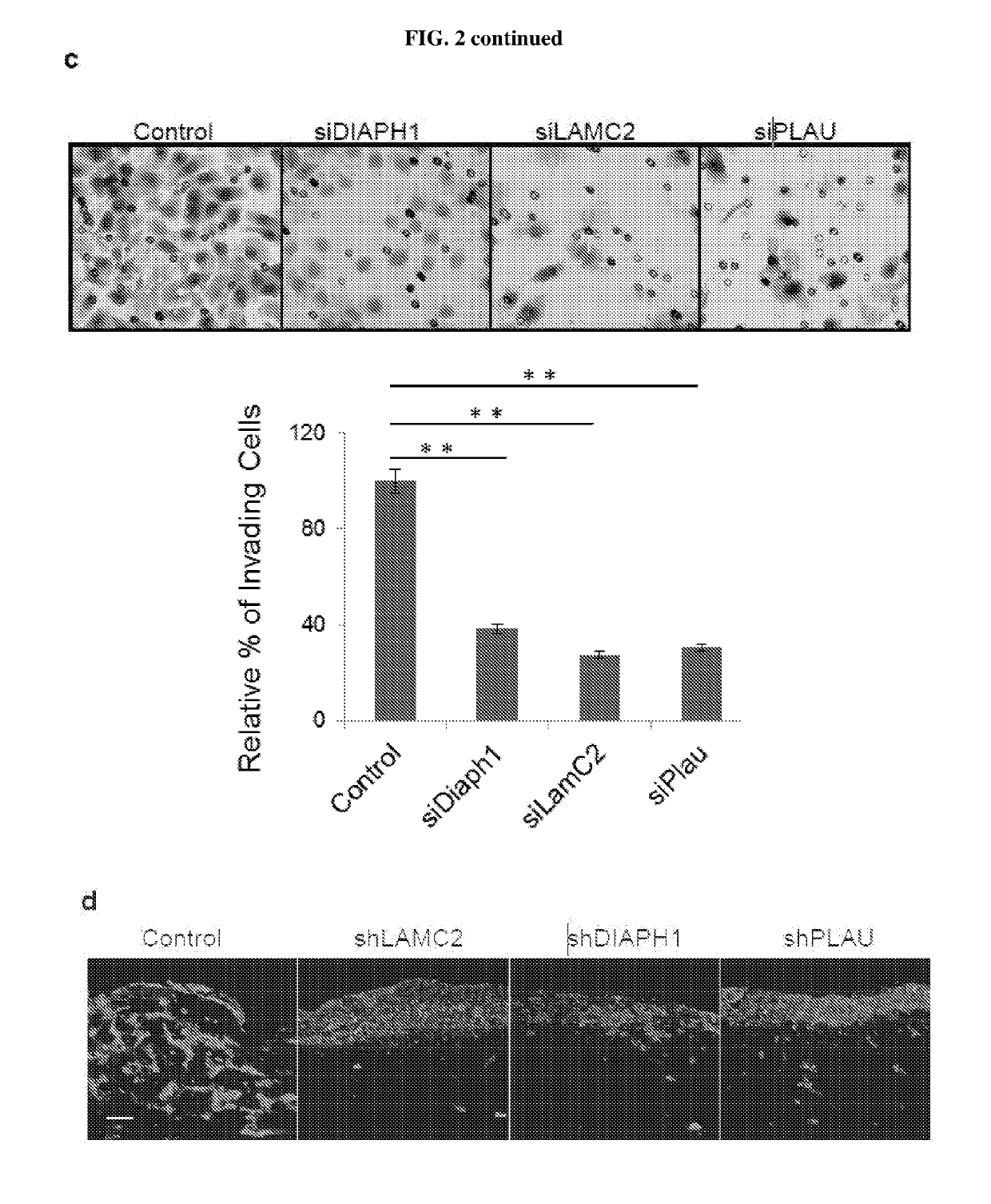 Consequences of a defective switch in cutaneous squamous cell carcinoma