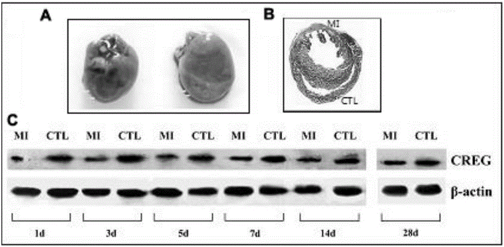 Medical application of CREG protein in preventing or treating myocardial infarction