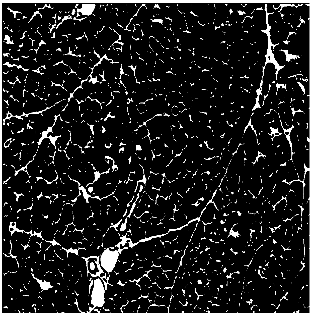 Application of pyrazolopyrimidine derivative for treating acute pancreatitis