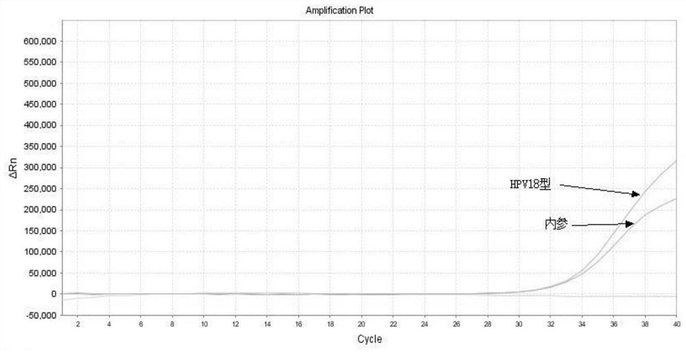 A gene detection kit free from nucleic acid purification