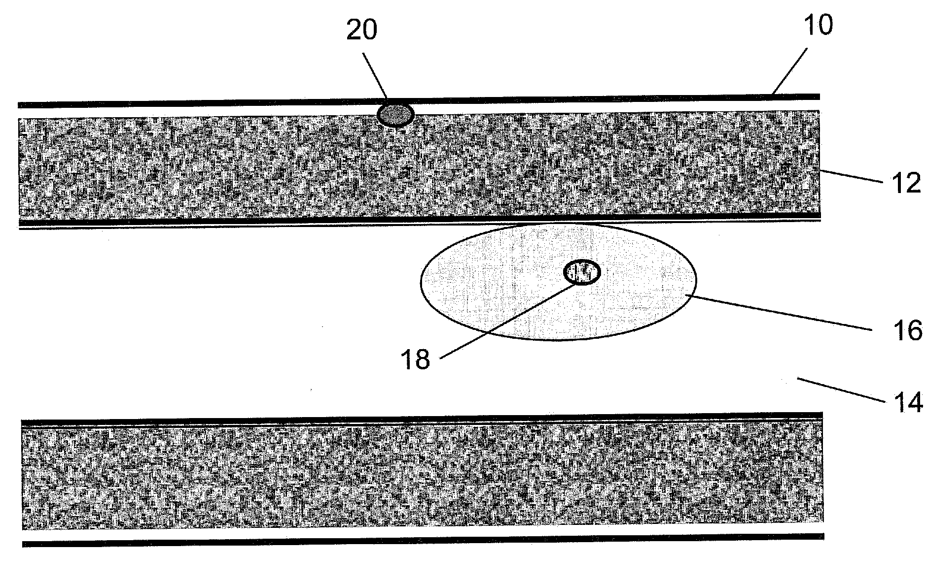 System for implanting, activating, and operating an implantable battery