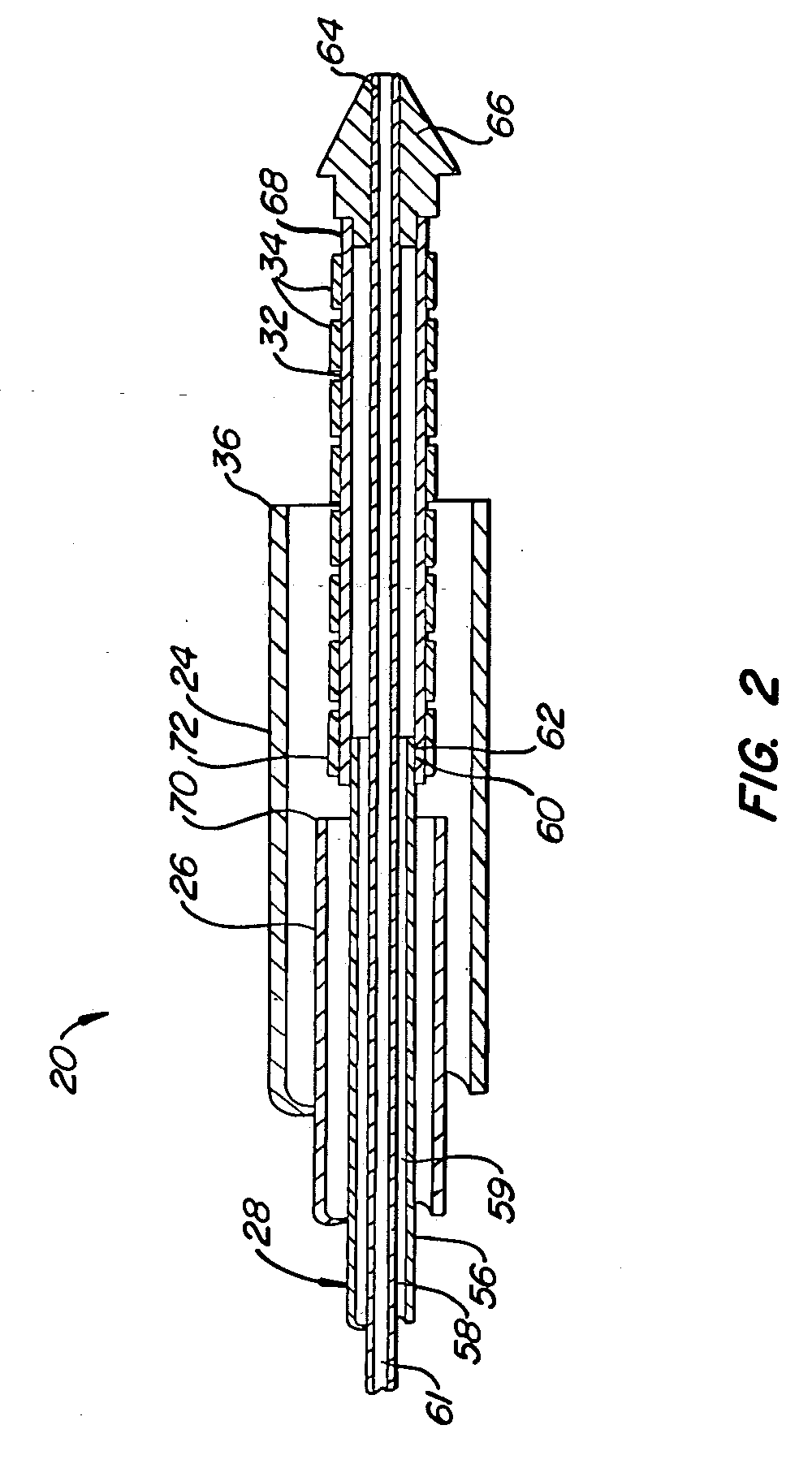 Stent deployment systems and methods