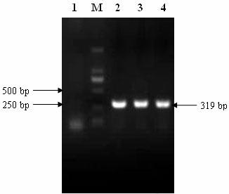 Universal RT-PCR (Reverse Transcription Polymerase Chain Reaction) detection primer and detection method for avian pneumovirus